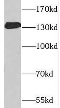 SPARCL1 Rabbit Polyclonal Antibody