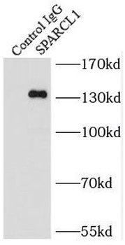SPARCL1 Rabbit Polyclonal Antibody
