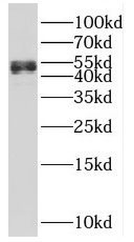 Spast Rabbit Polyclonal Antibody