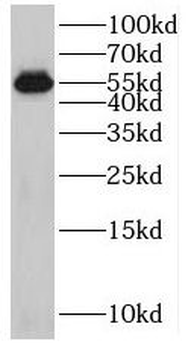 SPATA6 Rabbit Polyclonal Antibody