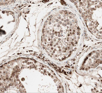 SPATA6 Rabbit Polyclonal Antibody