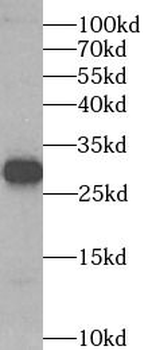 SPIN1 Rabbit Polyclonal Antibody