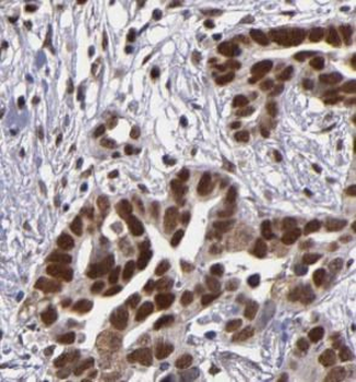 SPIN1 Rabbit Polyclonal Antibody