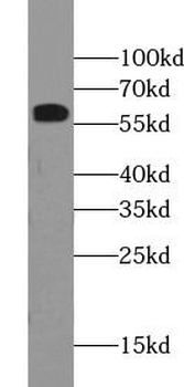 SPINT1 Rabbit Polyclonal Antibody