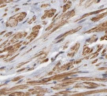SPINT1 Rabbit Polyclonal Antibody