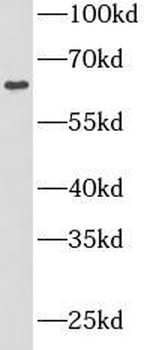 SPOCK2 Rabbit Polyclonal Antibody