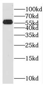 SPPL2A Rabbit Polyclonal Antibody