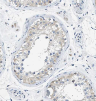 SPPL2A Rabbit Polyclonal Antibody