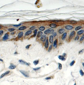 SPRR1B Rabbit Polyclonal Antibody