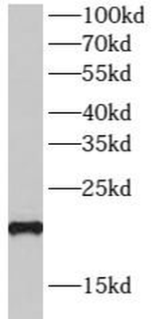 SPRR3 Rabbit Polyclonal Antibody