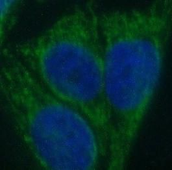 SPRR3 Rabbit Polyclonal Antibody
