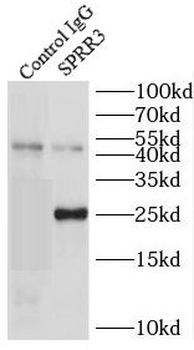 SPRR3 Rabbit Polyclonal Antibody