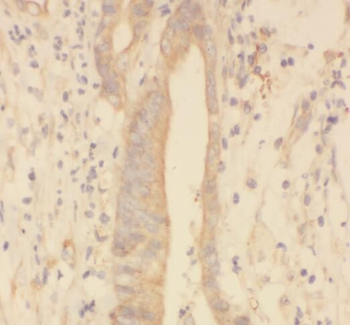 SPRR3 Rabbit Polyclonal Antibody