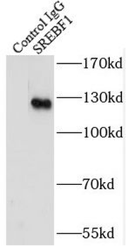 SREBF1 Rabbit Polyclonal Antibody