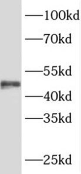 SRFBP1 Rabbit Polyclonal Antibody