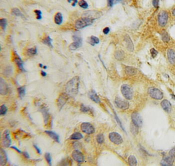 SRFBP1 Rabbit Polyclonal Antibody