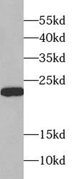 SRI Rabbit Polyclonal Antibody