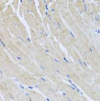 SRI Rabbit Polyclonal Antibody