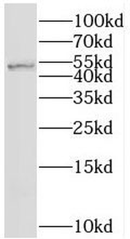 SRPX2 Rabbit Polyclonal Antibody