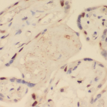 SRPX2 Rabbit Polyclonal Antibody