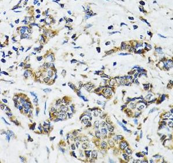 SSBP1 Rabbit Polyclonal Antibody