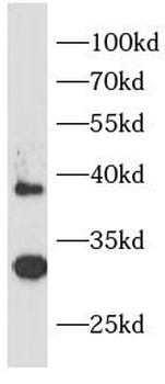 IL1RL1 Rabbit Polyclonal Antibody
