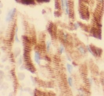 IL1RL1 Rabbit Polyclonal Antibody