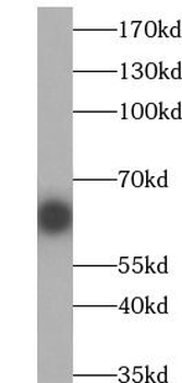 IL1RL1 Mouse Monoclonal Antibody