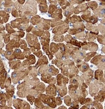 IL1RL1 Mouse Monoclonal Antibody