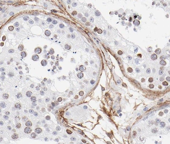 ST3GAL4 Rabbit Polyclonal Antibody