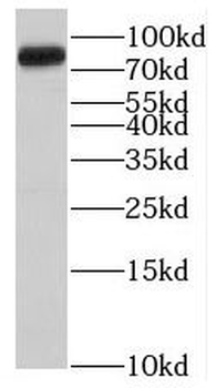 DENND2B Rabbit Polyclonal Antibody