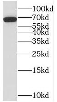 STAM2 Rabbit Polyclonal Antibody