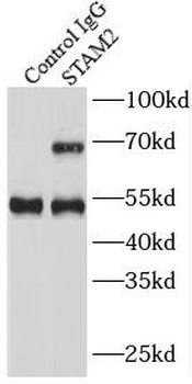STAM2 Rabbit Polyclonal Antibody