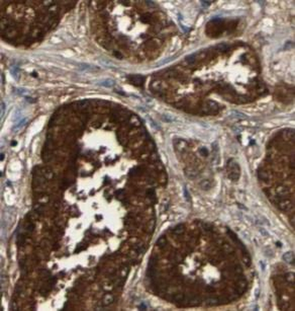 STAMBP Rabbit Polyclonal Antibody