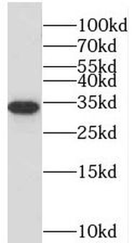 STC2 Rabbit Polyclonal Antibody