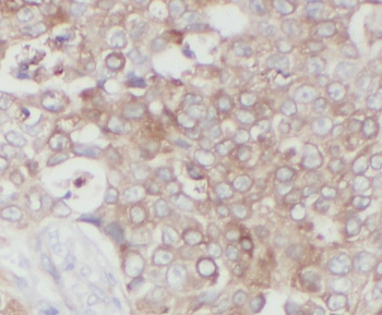 STC2 Rabbit Polyclonal Antibody