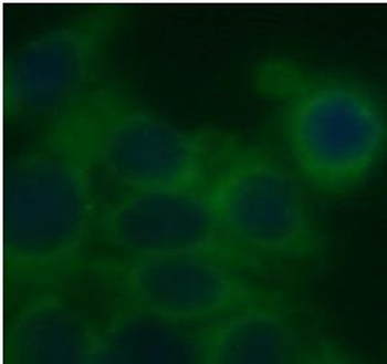 STARD5 Rabbit Polyclonal Antibody