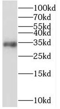 STARD7 Rabbit Polyclonal Antibody