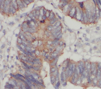 STARD7 Rabbit Polyclonal Antibody