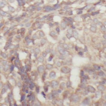 STAT1 Rabbit Polyclonal Antibody
