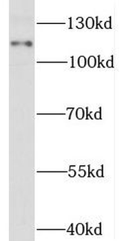 STAT2 Rabbit Polyclonal Antibody
