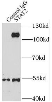 STAT2 Rabbit Polyclonal Antibody