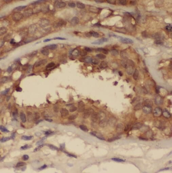 STAT2 Rabbit Polyclonal Antibody