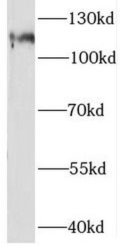 STAT2 Rabbit Polyclonal Antibody