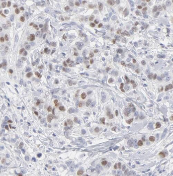 STAT2 Rabbit Polyclonal Antibody