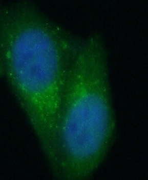 STAT3 Mouse Monoclonal Antibody