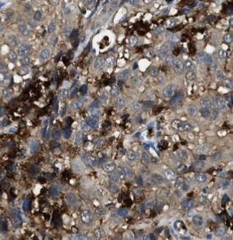 STAT3 Mouse Monoclonal Antibody