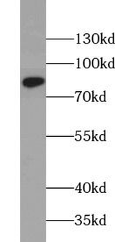 STAT4 Rabbit Polyclonal Antibody