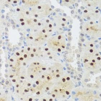STAT4 Rabbit Polyclonal Antibody