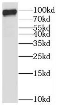 STAT5B Rabbit Polyclonal Antibody